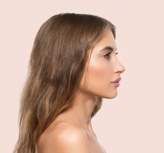 Rinoplastia